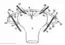 Fig. 01 - METHODS AND SYSTEMS FOR TREATMENT OF PROLAPSE