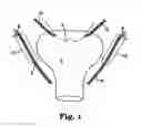 Fig. 02 - METHODS AND SYSTEMS FOR TREATMENT OF PROLAPSE