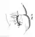 Fig. 10 - METHODS AND SYSTEMS FOR TREATMENT OF PROLAPSE