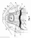Fig. 11 - METHODS AND SYSTEMS FOR TREATMENT OF PROLAPSE