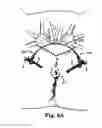 Fig. 13 - METHODS AND SYSTEMS FOR TREATMENT OF PROLAPSE