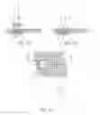 Fig. 04 - ATRAUMATIC MEDICAL DEVICE ANCHORING AND DELIVERY SYSTEM WITH ENHANCED ANCHORING