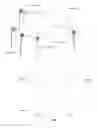 Fig. 33 - ATRAUMATIC MEDICAL DEVICE ANCHORING AND DELIVERY SYSTEM WITH ENHANCED ANCHORING