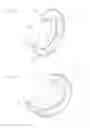 Fig. 02 - Curved surgical fasteners for securing prosthetic devices to tissue
