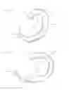 Fig. 04 - Curved surgical fasteners for securing prosthetic devices to tissue
