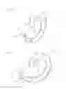 Fig. 08 - Curved surgical fasteners for securing prosthetic devices to tissue