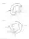 Fig. 14 - Curved surgical fasteners for securing prosthetic devices to tissue