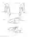 Fig. 15 - Curved surgical fasteners for securing prosthetic devices to tissue