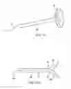Fig. 08 - Annulotomy Closure Device and Related Methods
