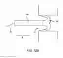Fig. 09 - Annulotomy Closure Device and Related Methods