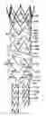 Fig. 01 - Implantable Endoprosthesis for Aortic Aneurysm