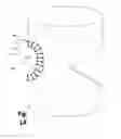 Fig. 03 - Circular Sectional Inserts For Insertion with a Trunk Section in Endoprosthesis for Aortic Aneurysm
