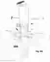 Fig. 05 - Circular Sectional Inserts For Insertion with a Trunk Section in Endoprosthesis for Aortic Aneurysm