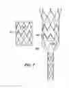 Fig. 08 - Circular Sectional Inserts For Insertion with a Trunk Section in Endoprosthesis for Aortic Aneurysm