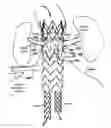 Fig. 01 - Sectional Inserts for Trunk Section in Endoprosthesis for Aortic Aneurysm
