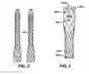Fig. 03 - Sectional Inserts for Trunk Section in Endoprosthesis for Aortic Aneurysm