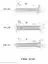 Fig. 03 - Graft with expandable region and methods of making and using the same