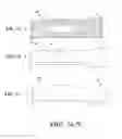 Fig. 08 - Graft with expandable region and methods of making and using the same