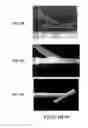 Fig. 13 - Graft with expandable region and methods of making and using the same