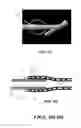 Fig. 14 - Graft with expandable region and methods of making and using the same