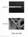 Fig. 19 - Graft with expandable region and methods of making and using the same
