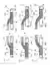 Fig. 23 - Graft with expandable region and methods of making and using the same