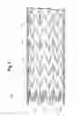 Fig. 02 - Layered medical device with improved adhesion and methods of making