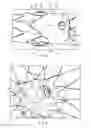 Fig. 03 - Prosthesis having pivoting fenestration