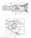 Fig. 04 - Prosthesis having pivoting fenestration