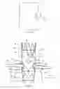 Fig. 08 - Prosthesis having pivoting fenestration