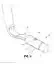 Fig. 06 - Corneal implant retaining devices and methods of use