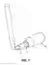 Fig. 08 - Corneal implant retaining devices and methods of use