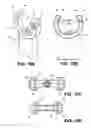 Fig. 11 - Corneal implant retaining devices and methods of use