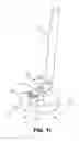 Fig. 12 - Corneal implant retaining devices and methods of use