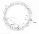 Fig. 01 - Ocular collar stent for treating narrowing of the irideocorneal angle