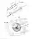 Fig. 11 - Ocular collar stent for treating narrowing of the irideocorneal angle