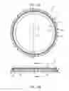 Fig. 12 - Ocular collar stent for treating narrowing of the irideocorneal angle