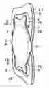 Fig. 01 - Intraocular lens structure