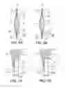 Fig. 05 - Intraocular lens structure