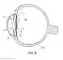 Fig. 07 - Intraocular lens structure
