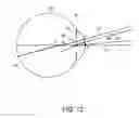 Fig. 10 - Intraocular lens structure