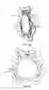 Fig. 14 - Intraocular lens structure