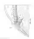 Fig. 05 - Accommodating intraocular lens assembly