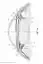 Fig. 15 - Accommodating intraocular lens assembly