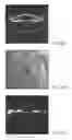 Fig. 07 - Systems and methods for implanting and examining intraocular lens
