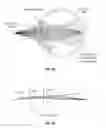 Fig. 09 - Systems and methods for implanting and examining intraocular lens