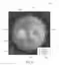 Fig. 22 - Systems and methods for implanting and examining intraocular lens