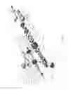Fig. 04 - Handle assembly for implant delivery apparatus comprising a force limiter, a displacement limiter and/or a brake frame assembly