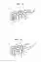 Fig. 04 - ORTHOPEDIC IMPLANTS