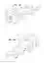 Fig. 05 - ORTHOPEDIC IMPLANTS